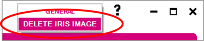 2.4 Settings Cog & Delete Iris Image.png